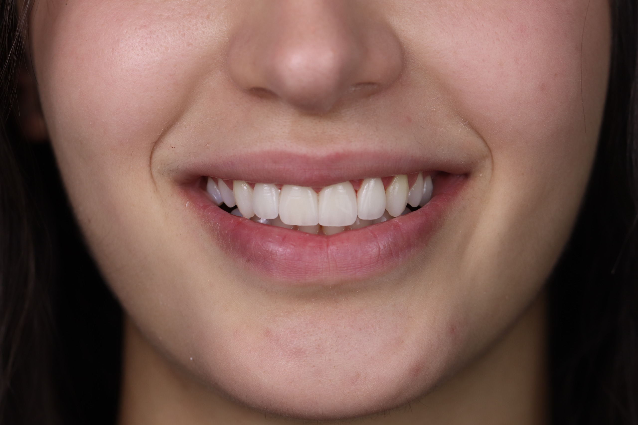 After dental treatment at Deedz Dental Clinic