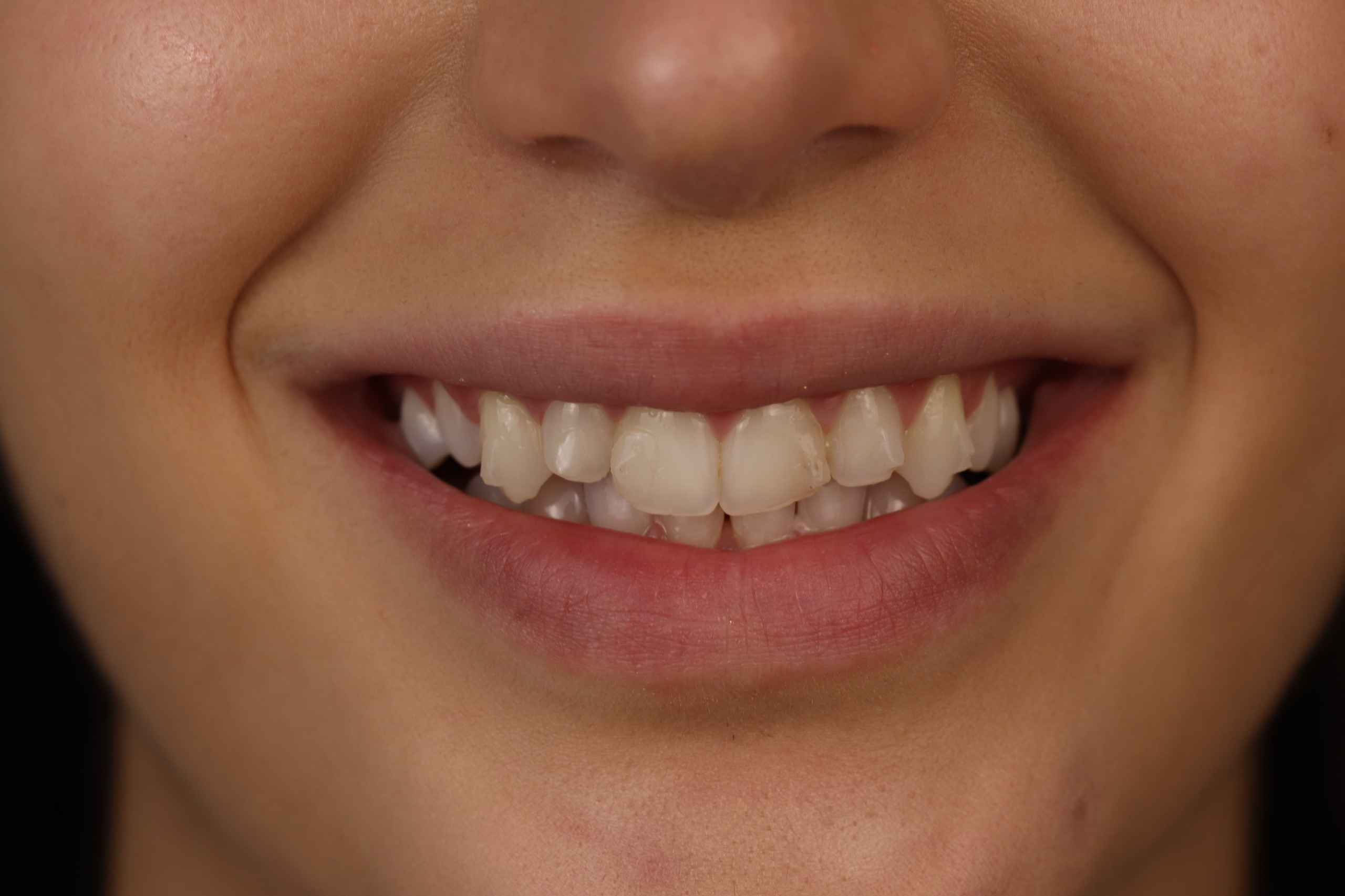 Before dental treatment